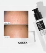 COSRX BHA Blackhead Power Liquid – Pore-Clearing Exfoliating Toner for Smoother Skin 100ml - Image 2