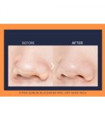 Apieu Goblin Blackhead 3-Step Nose Pack – Complete Blackhead Removal & Pore Care Kit 1pcs - Image 4